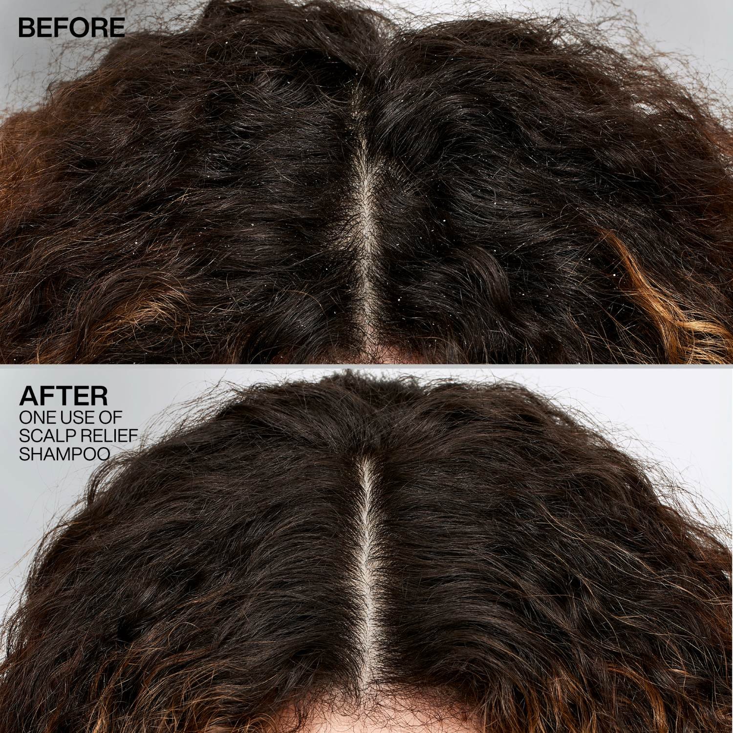 Scalp Relief Dandruff Control Shampoo Av Redken